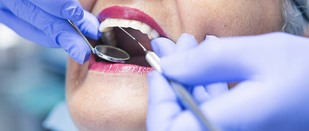 Best Emergency Wisdom Tooth Extraction in Semmes, AL