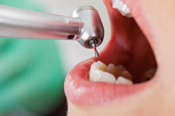 Best Walk-In Emergency Dental Services in Semmes, AL